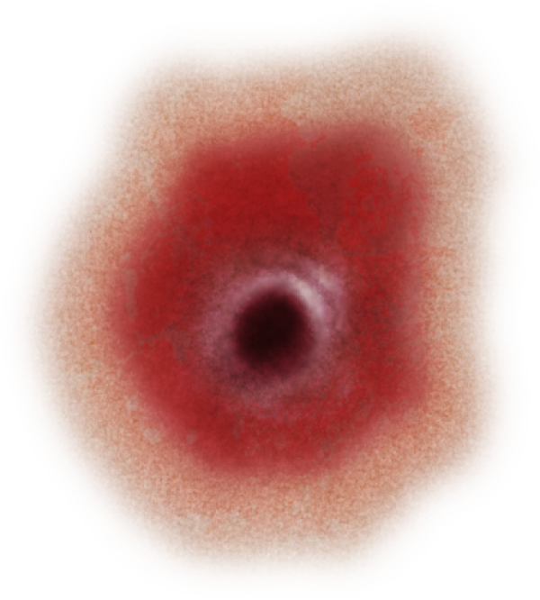 Wound PNG Free Download 6